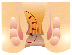 ジオン注アルタ療法の投与後2